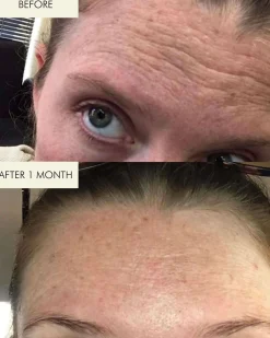 1.2% Clean Algae Retinol Face Oil for Anti-Aging and Wrinkles with Green Tea