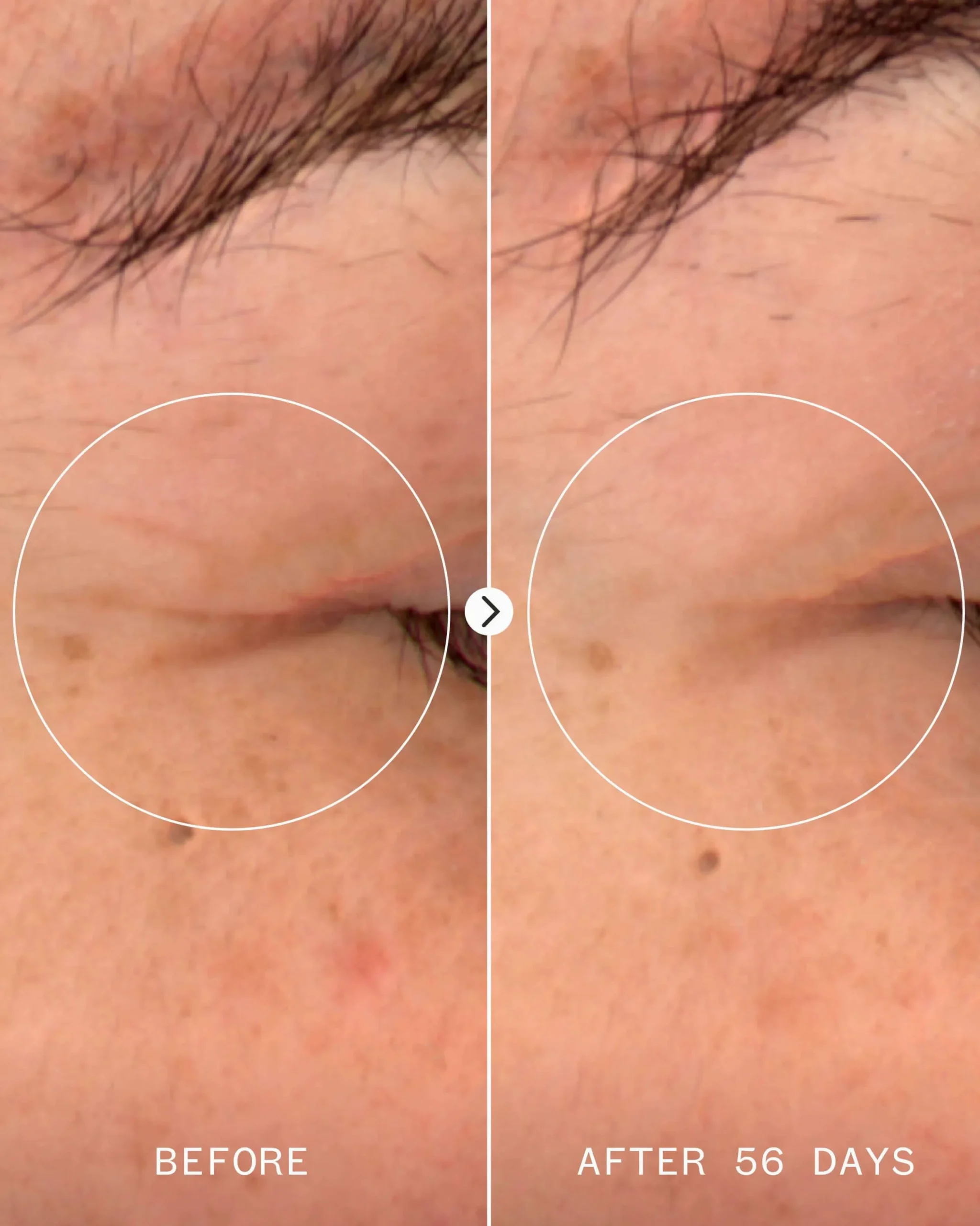 Age Confidence NAD+ & Tri-peptide Serum