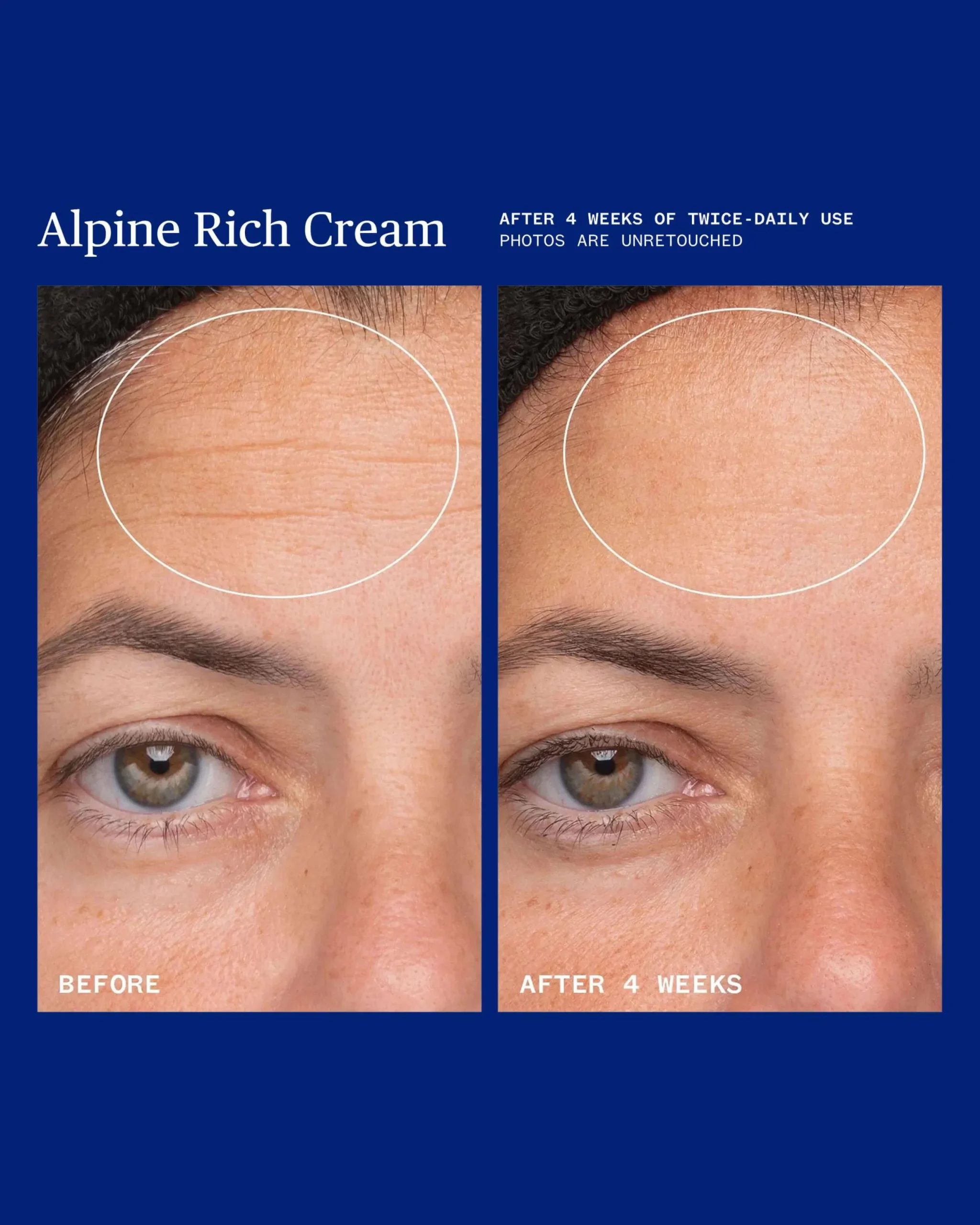 Alpine Rich Cream Barrier Moisturizer for Dry & Sensitive Skin