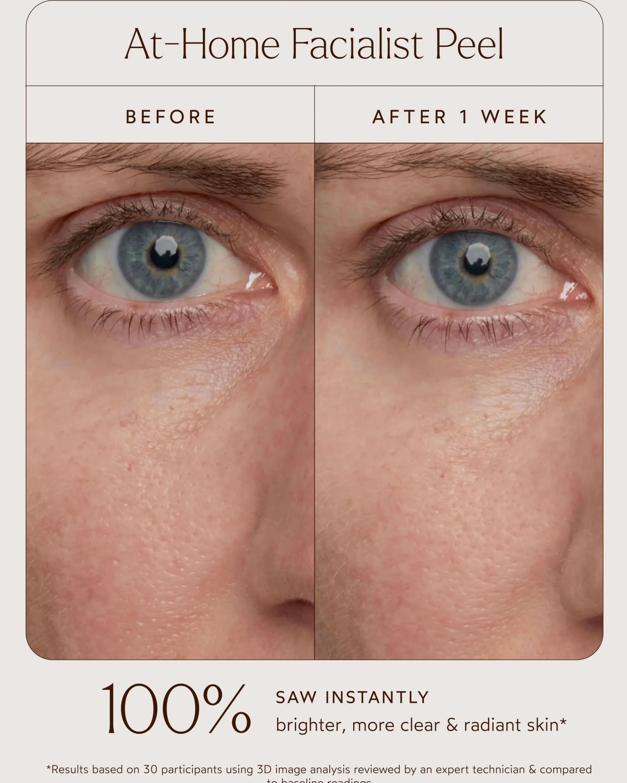 At-Home Facialist Peel