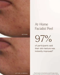 At-Home Facialist Peel