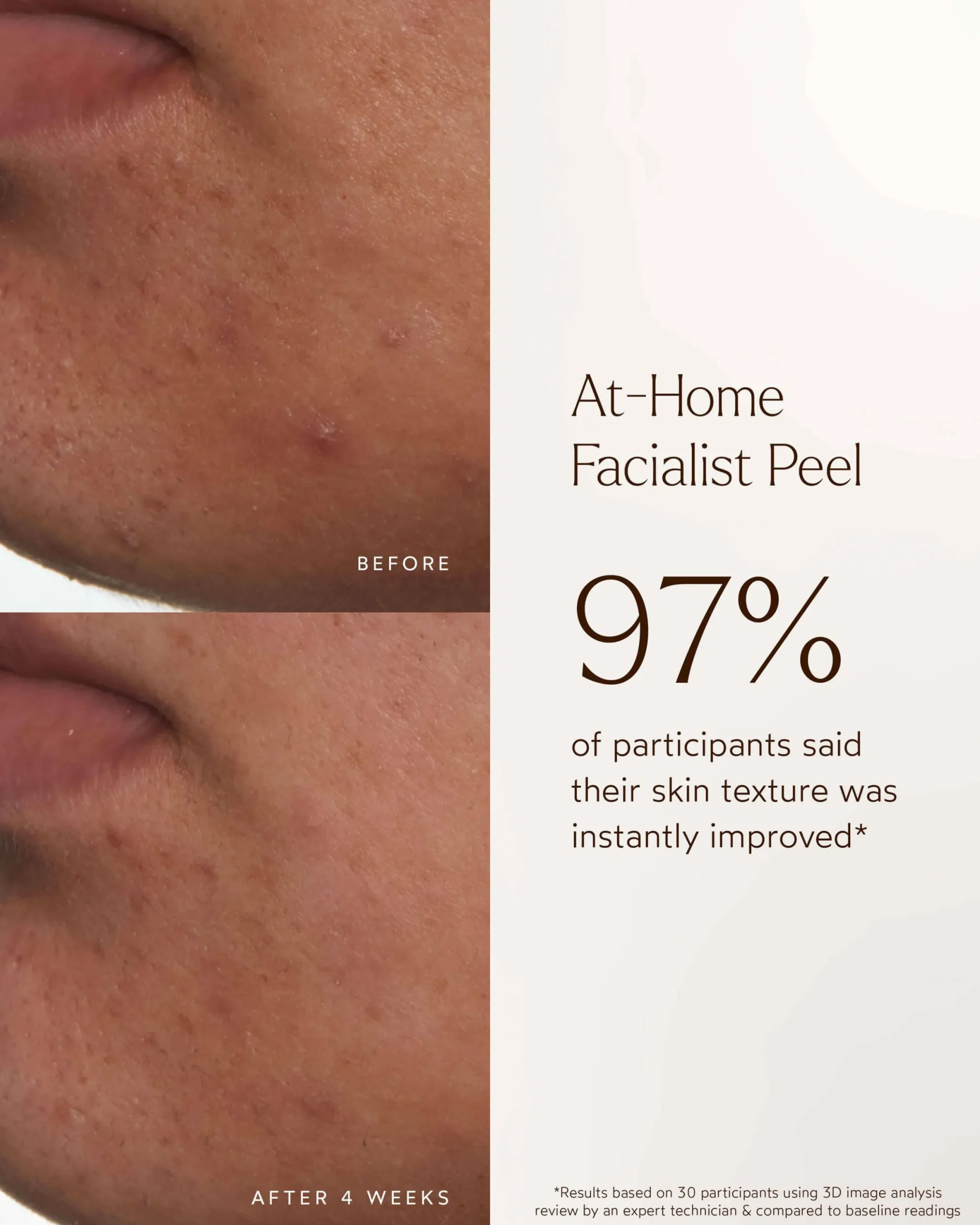 At-Home Facialist Peel