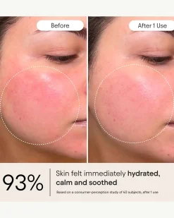 Barrier Repair Cream Moisturizer for Eczema, Barrier and Wrinkle Repair