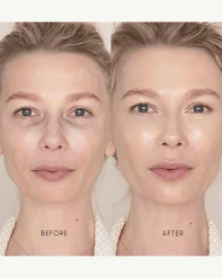 Best Skin Days Treatment Concealer