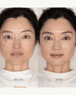 Best Skin Days Treatment Concealer