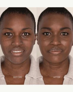 Best Skin Days Treatment Concealer