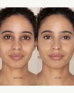 Best Skin Days Treatment Concealer