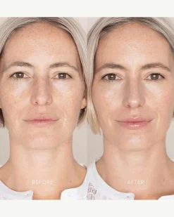 Best Skin Days Treatment Concealer
