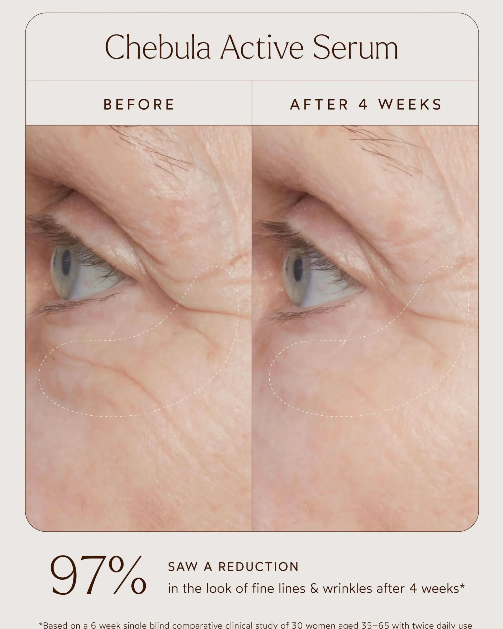 Chebula Active Anti-Aging Serum