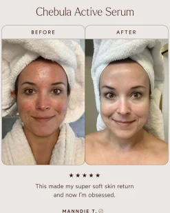 Chebula Active Anti-Aging Serum
