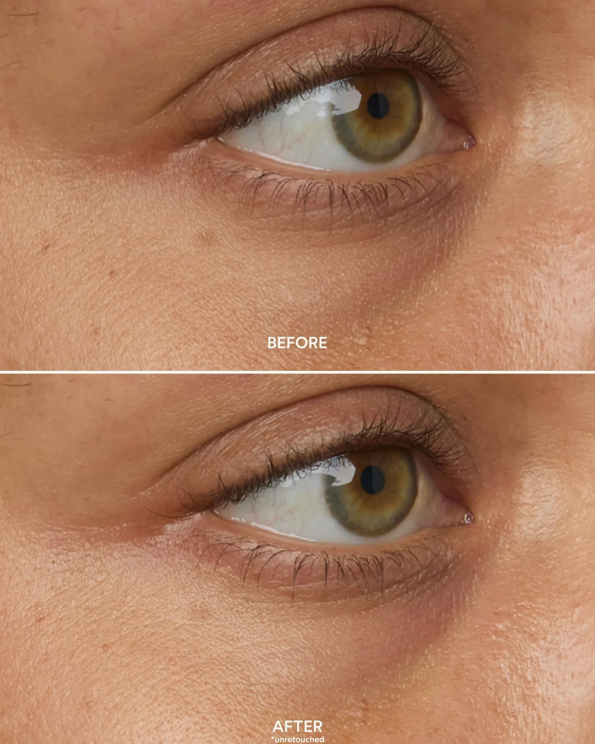 Chebula Multi-Corrective Eye Patches