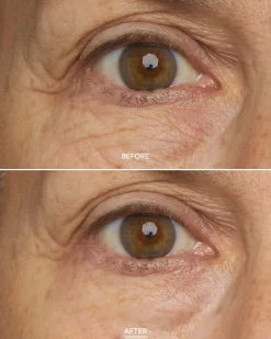 Chebula Multi-Corrective Eye Patches