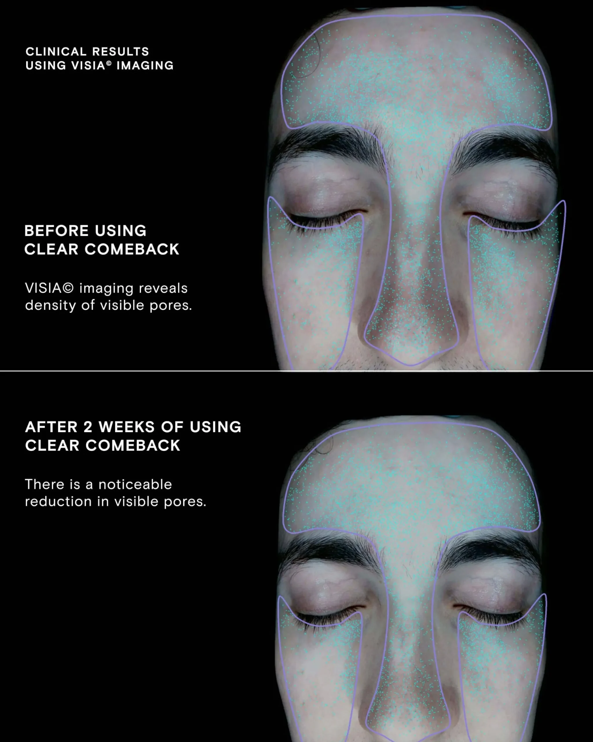Clear Comeback Probiotic Enzyme Power Serum