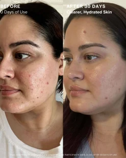 Clear Skin Mineral Milk 2% Salicylic Acid Acne Treatment with Niacinamide + Copper