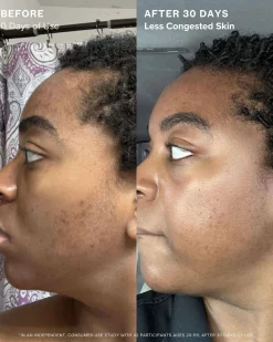 Clear Skin Mineral Milk 2% Salicylic Acid Acne Treatment with Niacinamide + Copper