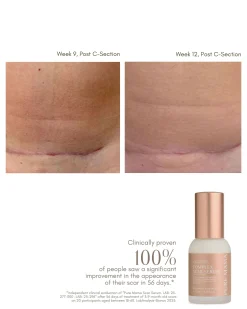 Complex Scar Serum