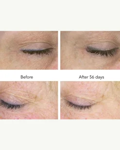 DNA-42 Clinicalift Serum