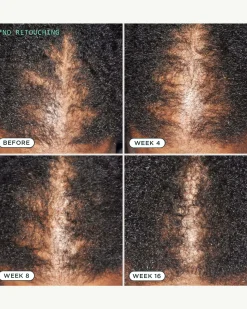 DNA Scalp Serum