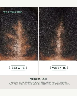 DNA Scalp Serum