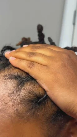 DNA Scalp Serum