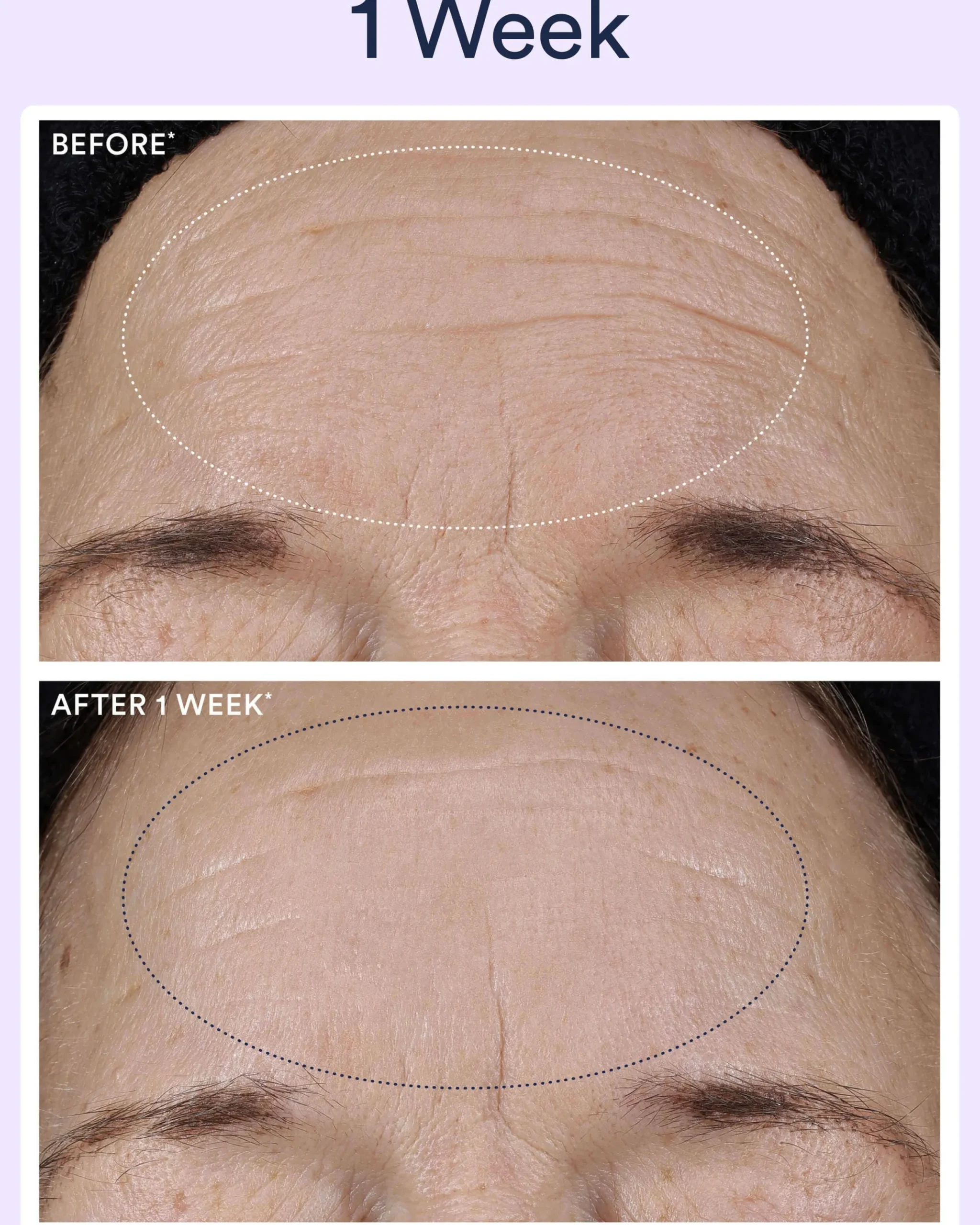 Dream Night Serum with Bio-Retinol