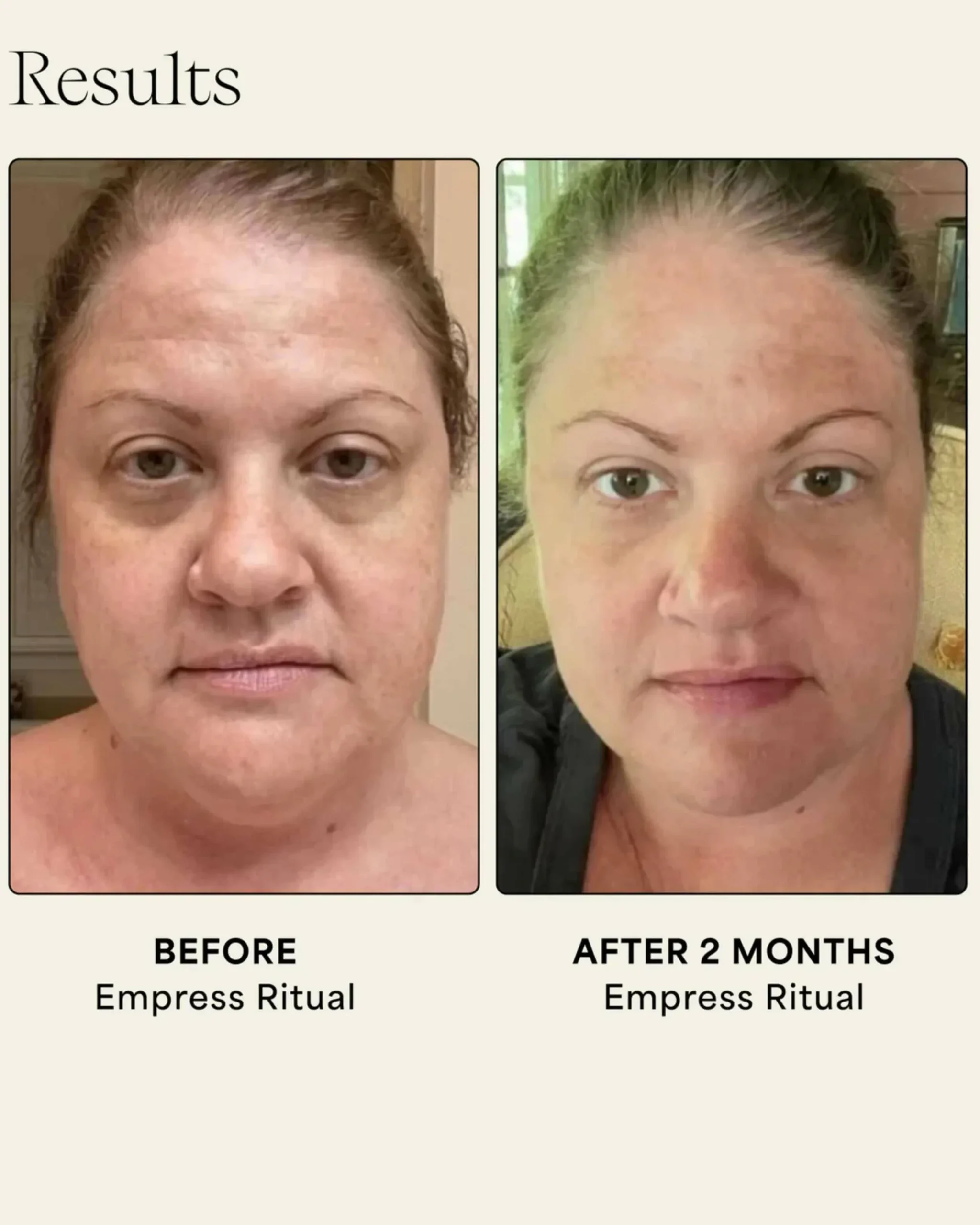 Empress Collection
