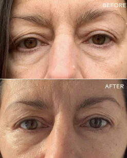 First Light Vitamin C + Caffeine Eye Cream