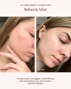 Le Complément Alimentaire – Ceramide-Rich Skin Supplement