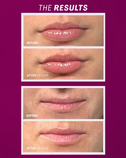 Lip Oasis™️ Glossy Treatment