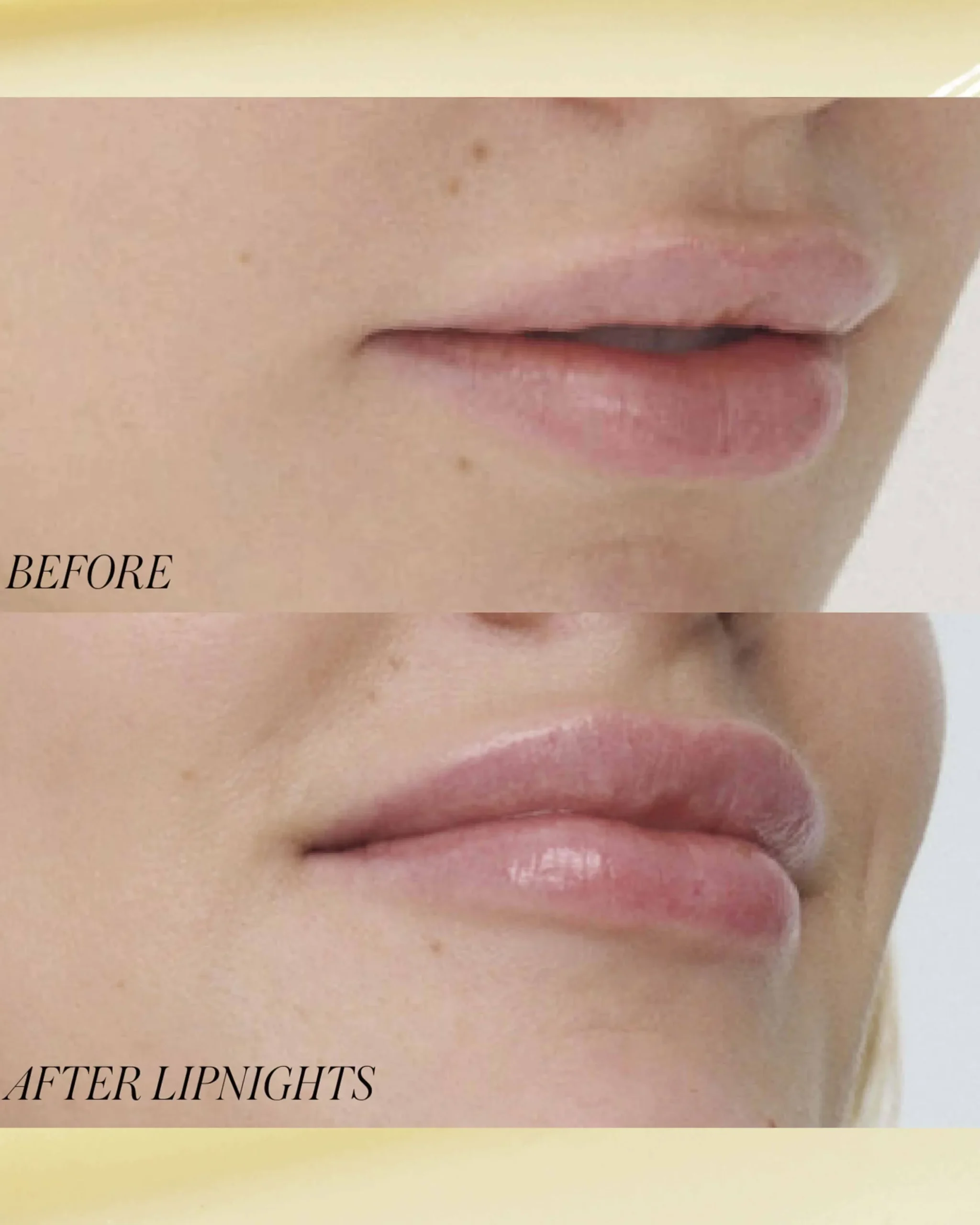 Lipnights Overnight Lip Mask