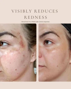 Luxury Beauty Serum