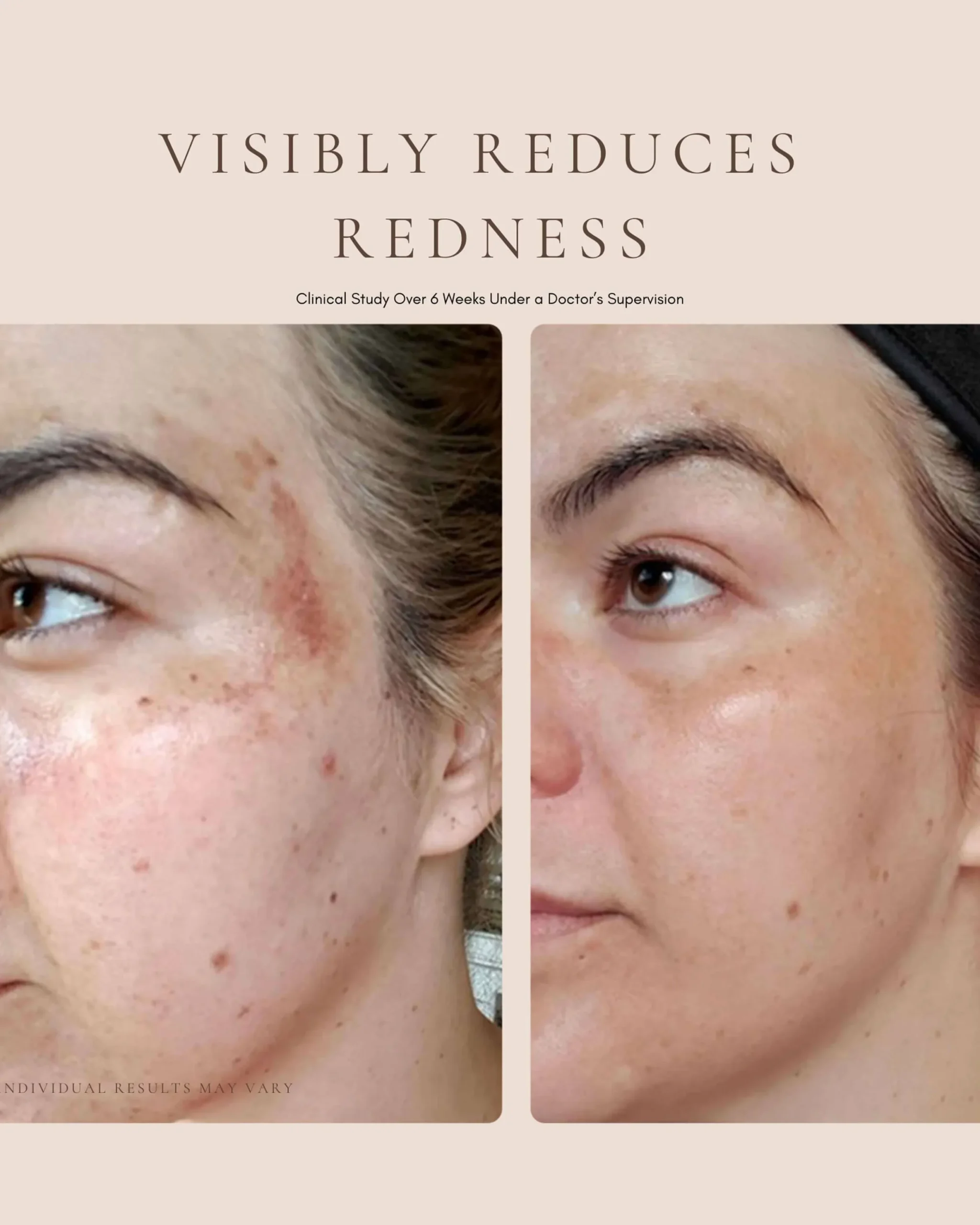 Luxury Beauty Serum