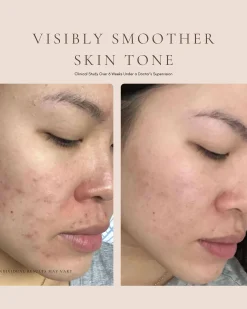 Luxury Beauty Serum