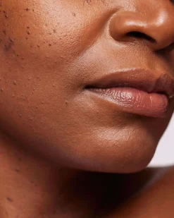 Moisturizer