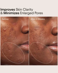 Pore Perfecting Liquid with 2% BHA + Borage