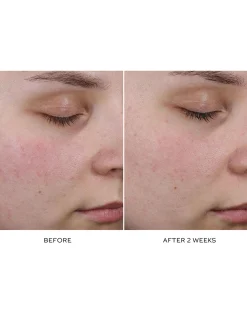 Pore Refining Complex