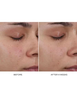 Pore Refining Complex
