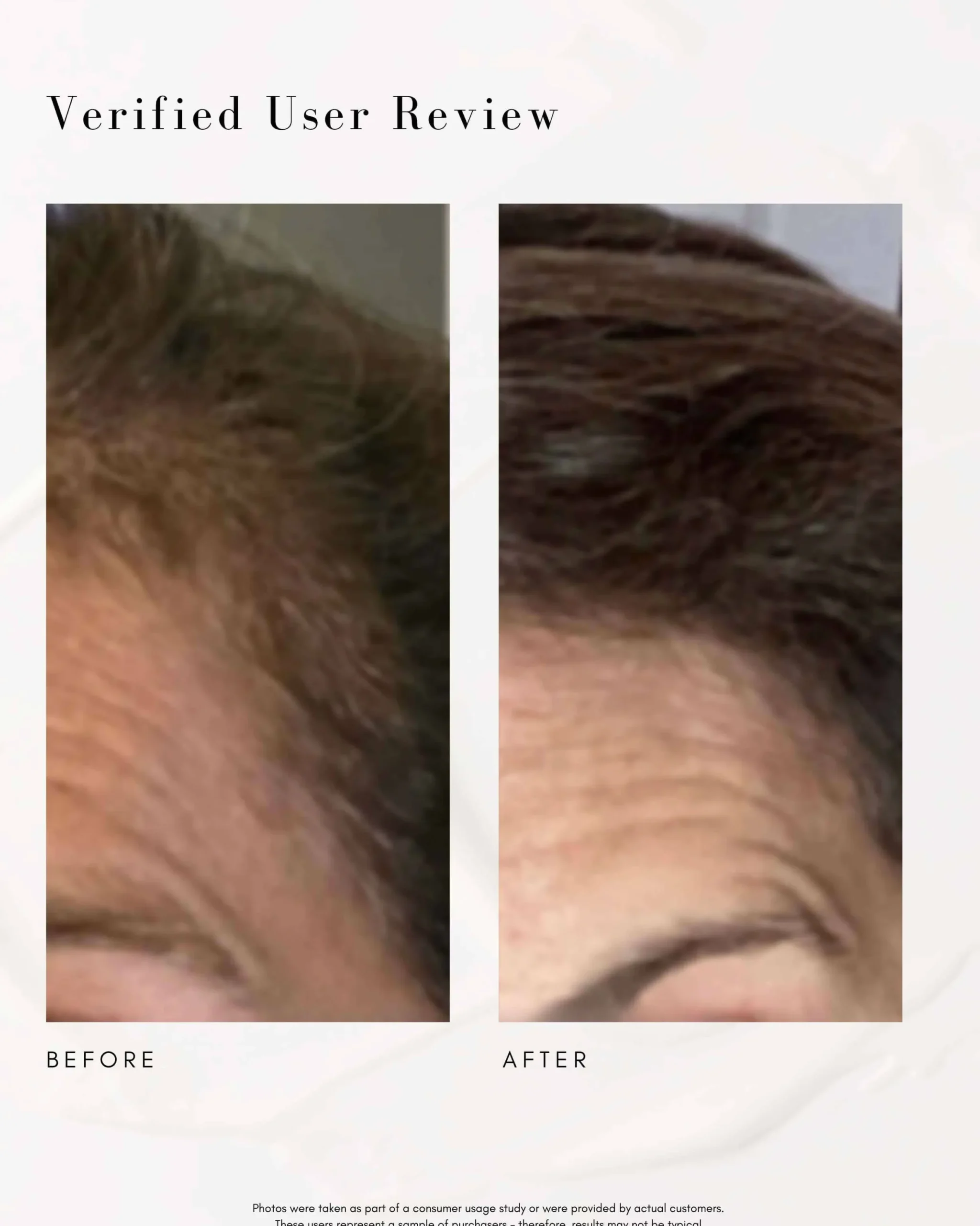 Power Fol Multi-Correctional Scalp and Hair Treatment