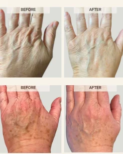 Power Pair: Activating Hand Serum + Treatment Boosting Gloves