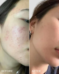 Purify Aloe + Amino Acid Gel Cleanser