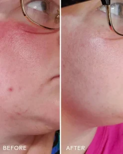 Radiance Grape Stem Cell + Squalane Day Cream