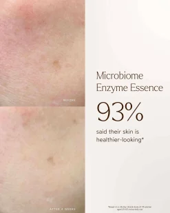 Renew Microbiome Enzyme Essence
