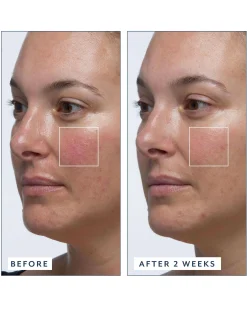 Royal Tulip Vitamin C Facial Oil