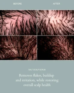 Salt Scalp Scrub