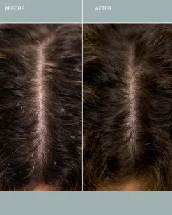 Salt Scalp Scrub