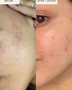 Sea Vitamin C Serum for Brightening Dark Spots & Redness with Algae