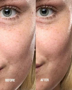 Skin Renewal Serum