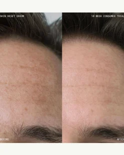 Skin Reset Serum