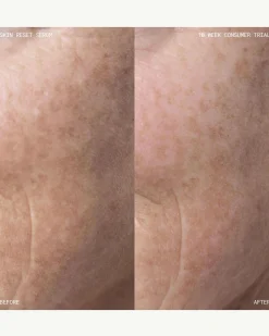 Skin Reset Serum