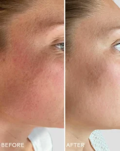 SkinHero™ Bakuchiol + Calendula Bio-Retinol Serum